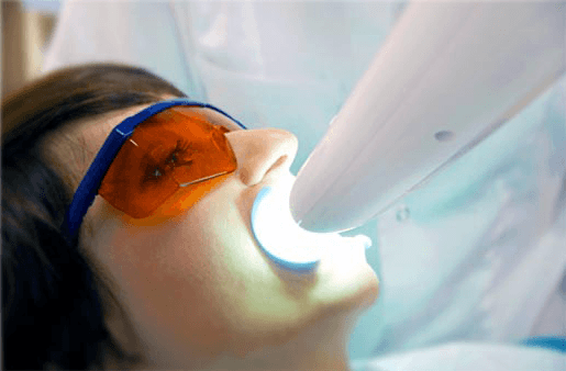 Understanding the Causes of Teeth Sensitivity Lisburn