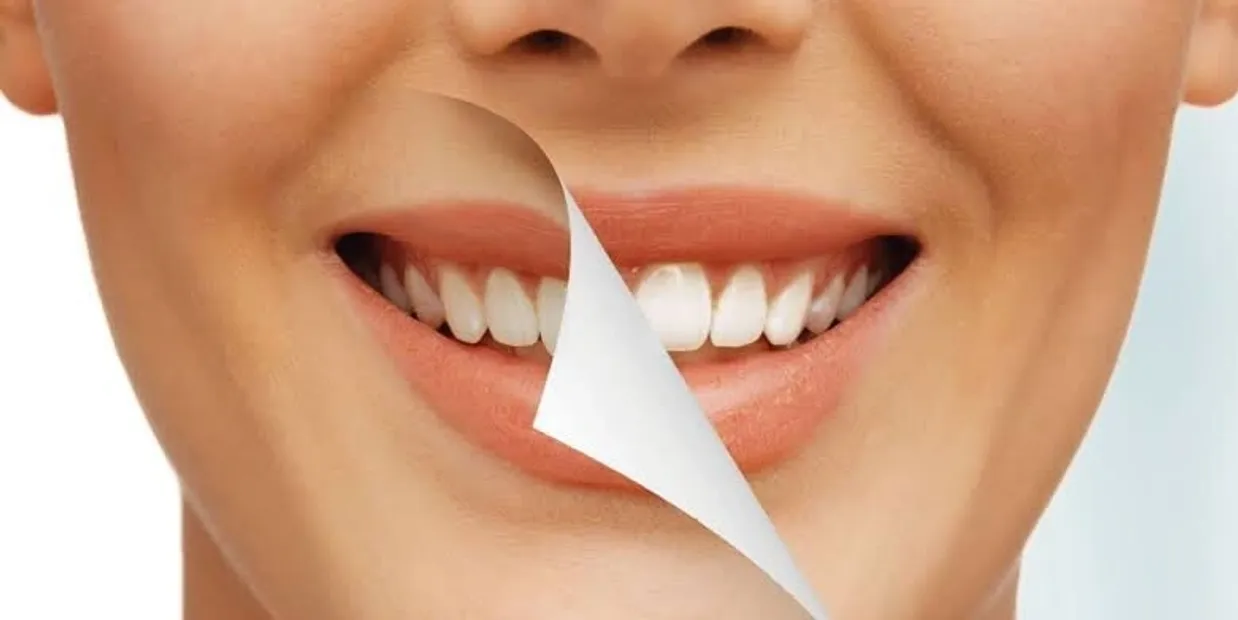 What Is Cosmetic Dentistry and How Can It Transform Your Smile Lisburn