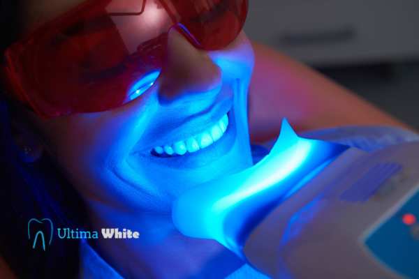 Professional Teeth Whitening Options Lisburn