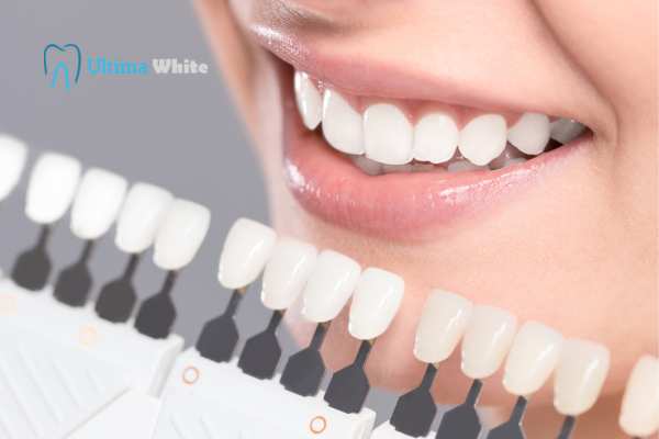 How to Maximise the Results of Your Laser Teeth Whitening Treatment Lisburn