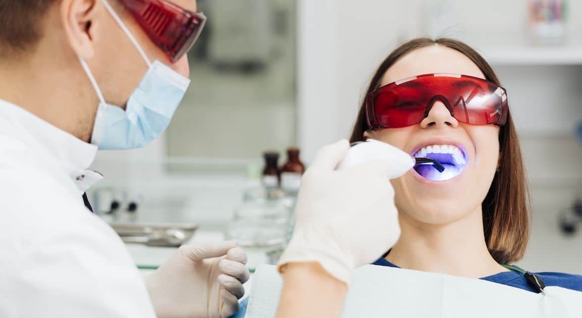 Do Dental Crowns Change Colour After Teeth Whitening Lisburn?