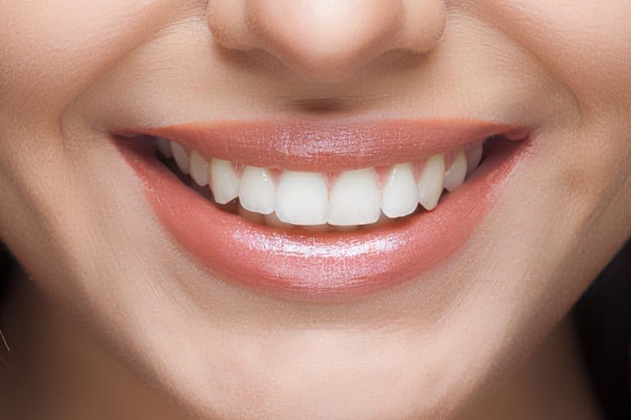 The Role of a Balanced Diet in Long-Term Whitening Results Lisburn