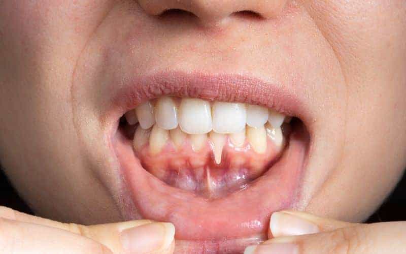 Final Thoughts: Building Lifelong Enamel Protection Habits Lisburn