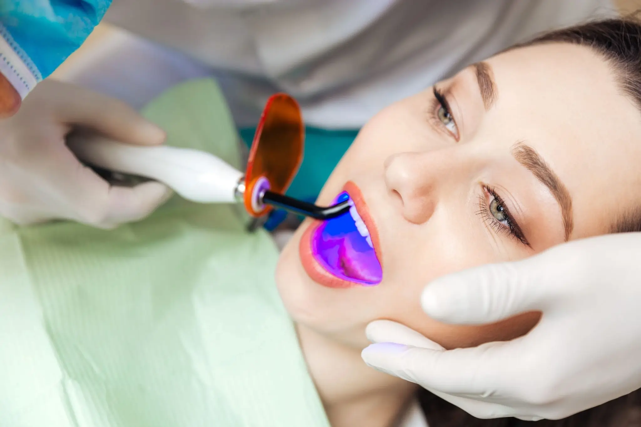 When Should You Stop DIY Whitening and Consider Professional Treatment Instead Lisburn?
