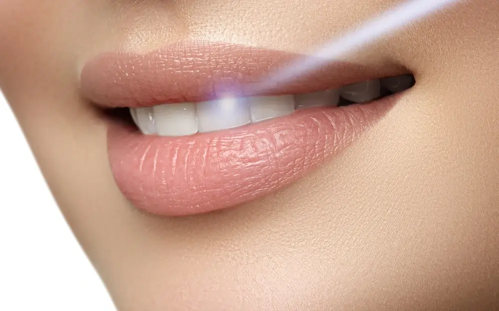 What Are Simple Ways to Improve the Look of Your Smile Lisburn?