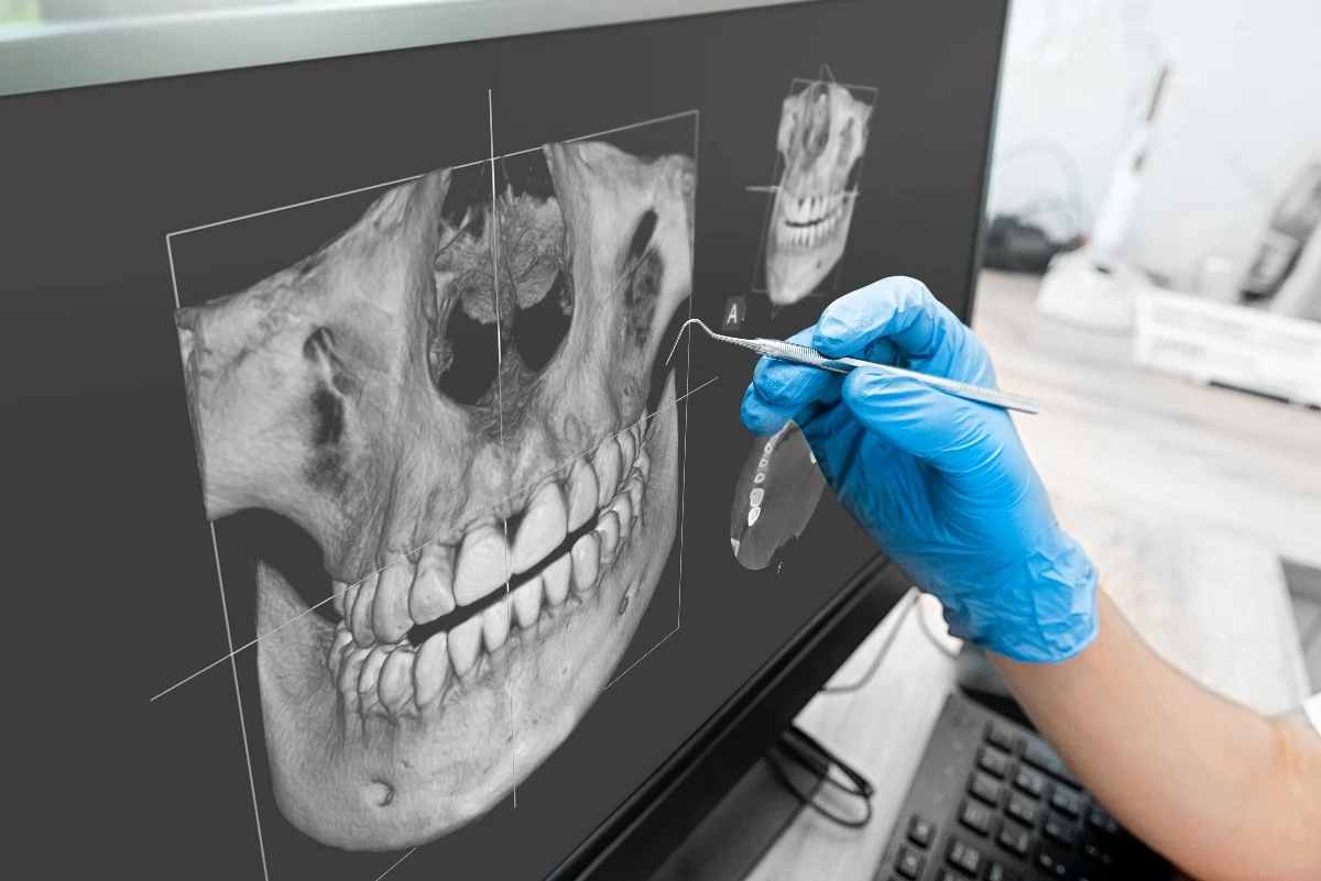 Key Benefits of 3D Printing for Patients and Dentists Lisburn