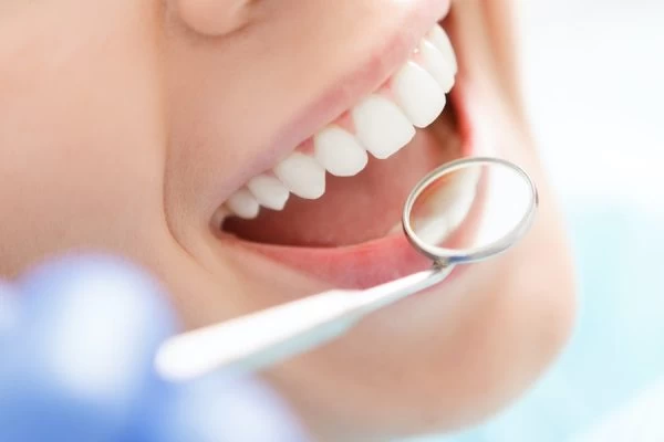 How to Maintain Your Whiter Smile After Treatment Lisburn