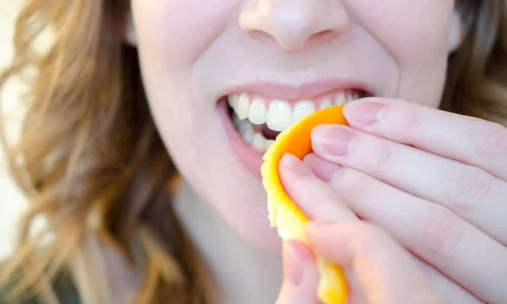 Are DIY Teeth Whitening Remedies Safe for Your Teeth and Enamel Lisburn?