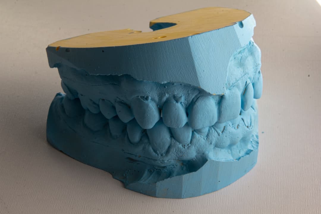 How Do Dental Implants Improve Jawbone Health and Oral Function Lisburn?