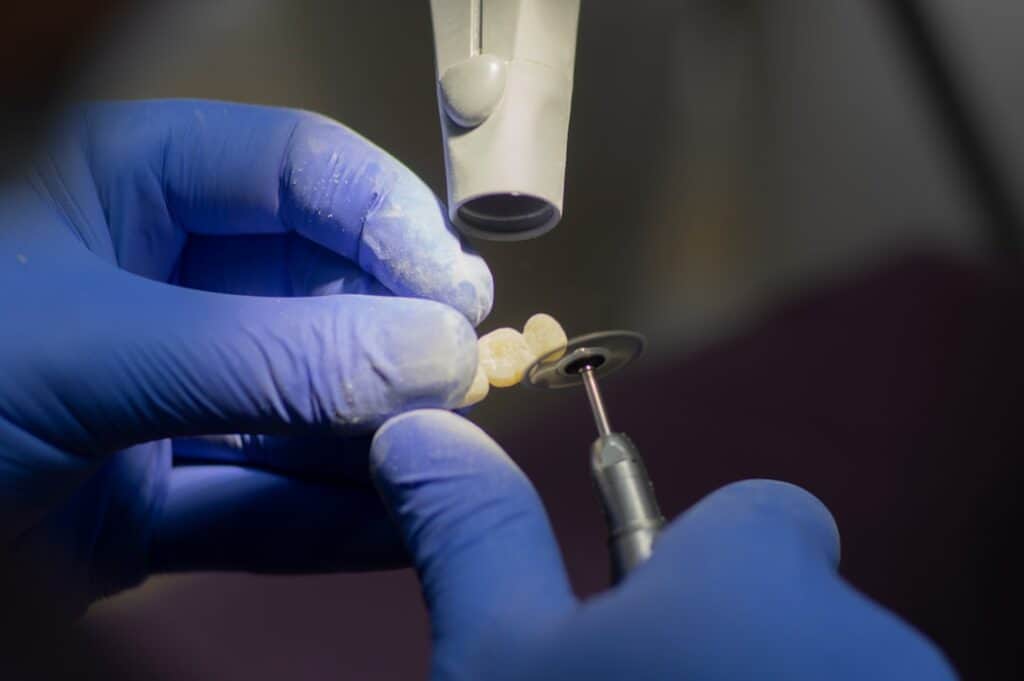 Customised Dental Solutions: Crowns, Aligners, and Implants Lisburn