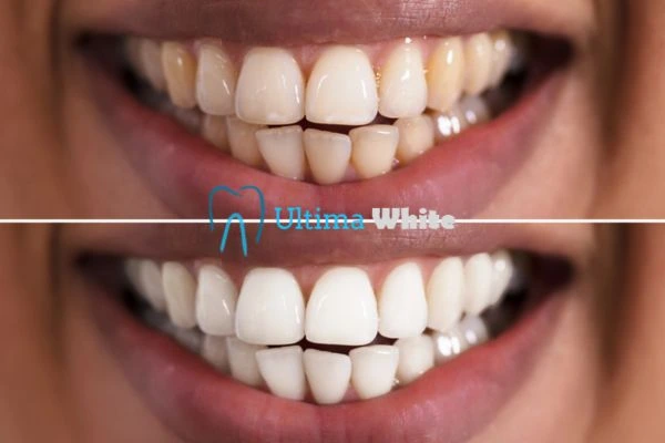 Long lasting results from Ultima White Lisburn